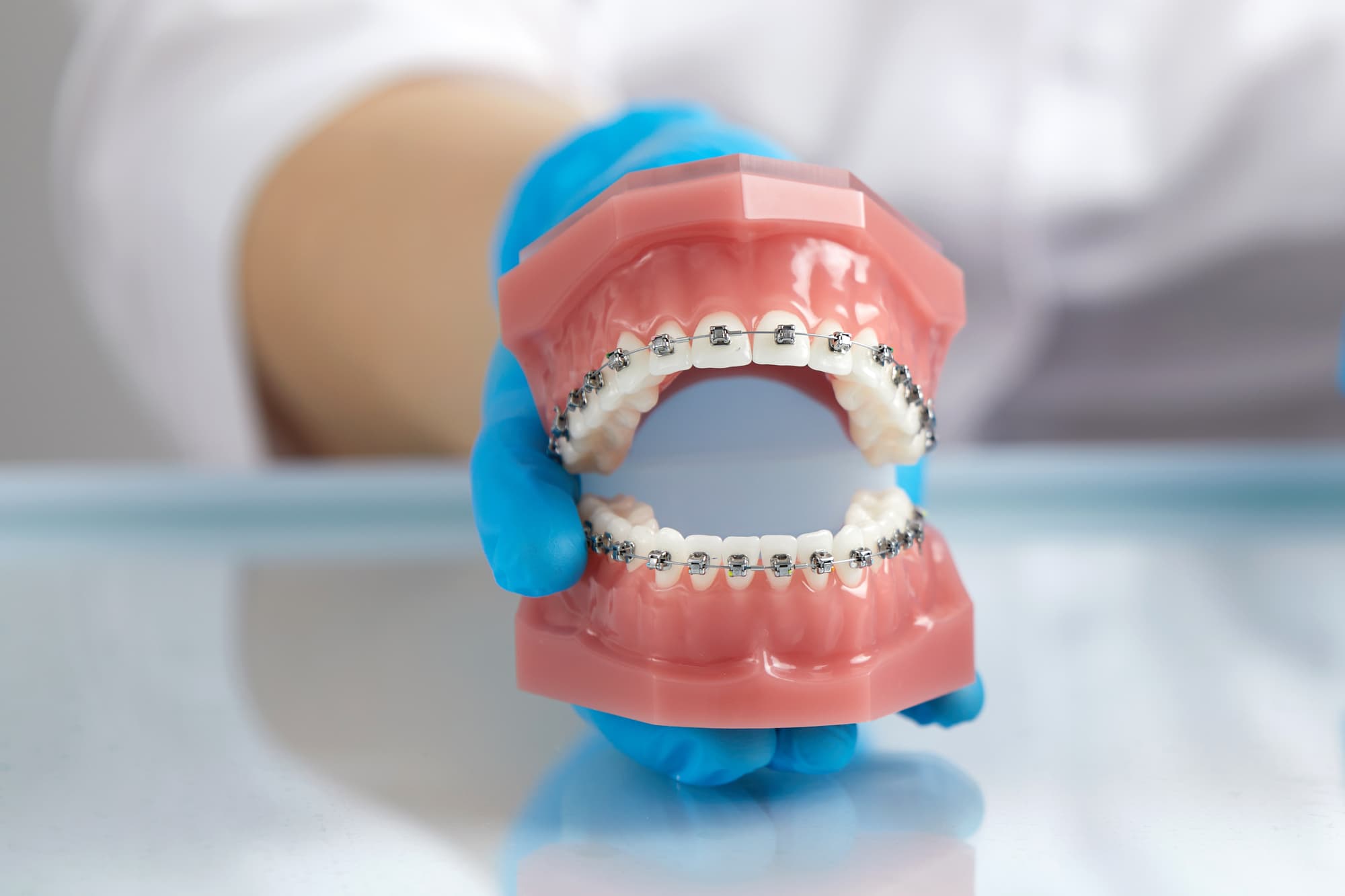 ワイヤー矯正の模型を持つ歯科医師の手元