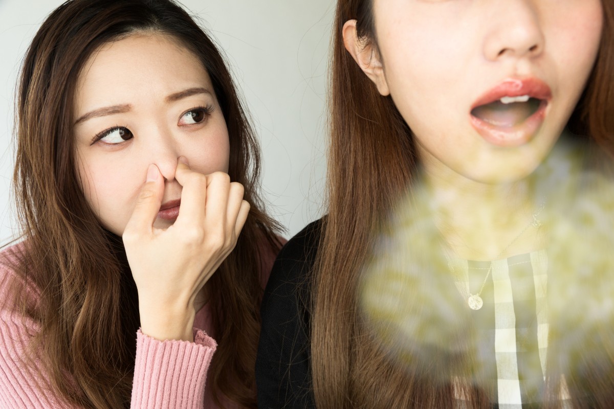 歯石が原因で口臭を発している女性