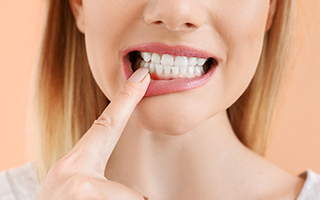 「歯ぐきの腫れ」や「歯ぐきからの出血」は歯周病が疑われます