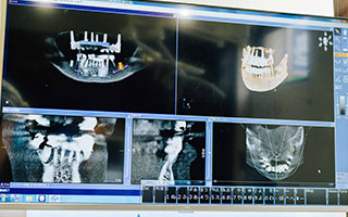 CT撮影によるDICOMデータ（骨の立体image）